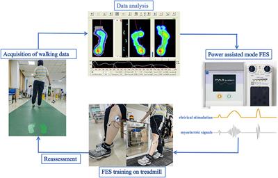 The effect of electromyographic feedback functional electrical stimulation on the plantar pressure in stroke patients with foot drop